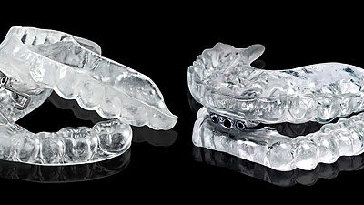 Why Patients Love This Dental Sleep Appliance